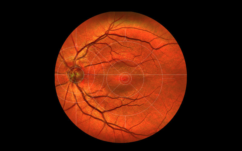 Brille von Einstoffen, Modell SS24 4248-6328